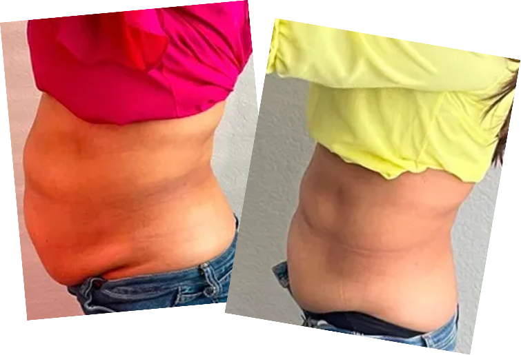Port St Lucie spa providing rejuvenating treatments and relaxing wellness experiences.